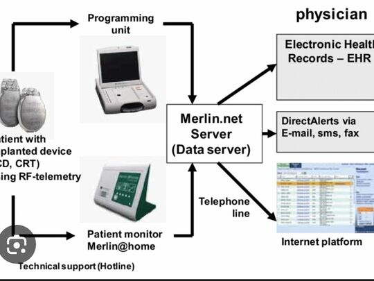 Remote pacemaker monitors 